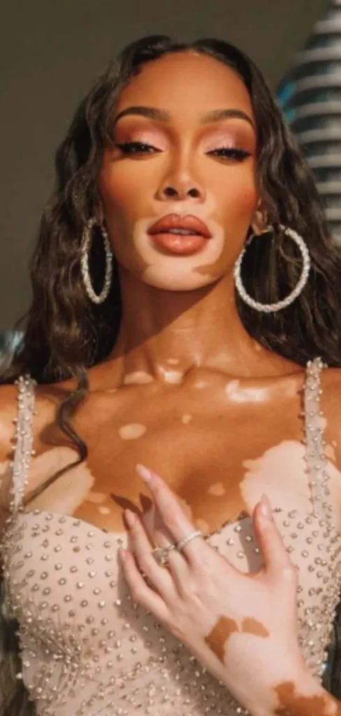 i am fat and ugly and i hate myself