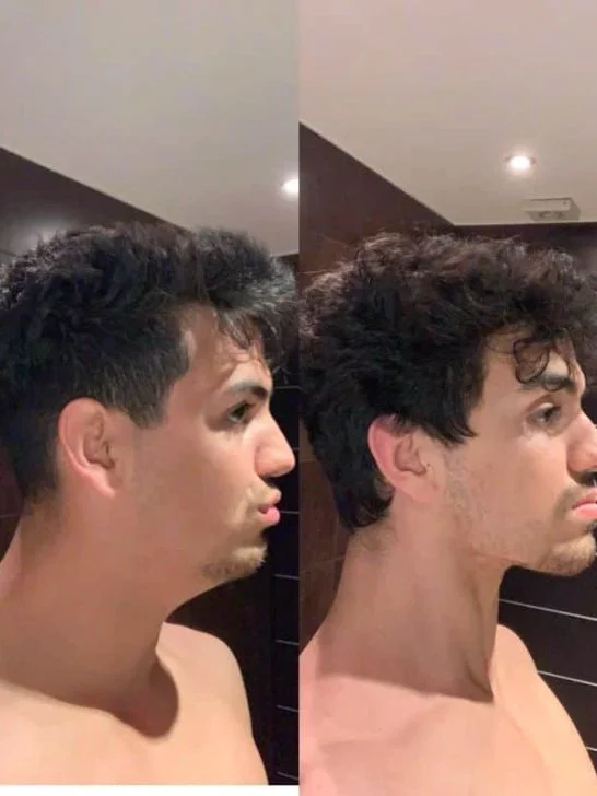 🔥6 non clickbait tips to Get Rid Of Double Chin FAST!👇